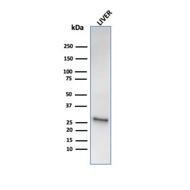 Western Blot - Anti-HSP27 Antibody [HSPB1/6490R] (A248877) - Antibodies.com