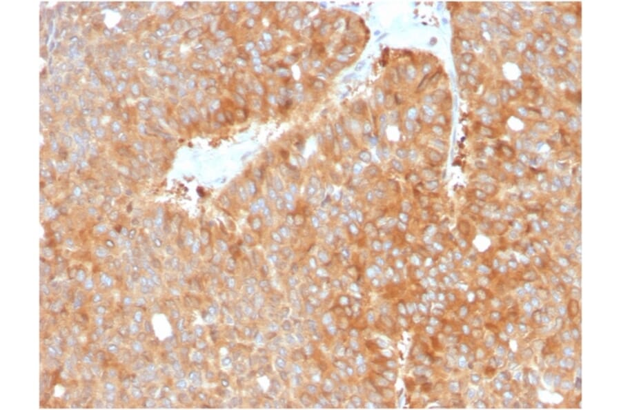 Immunohistochemistry - Anti-HSP90 beta Antibody [HSP90AB1/3952] (A248879) - Antibodies.com
