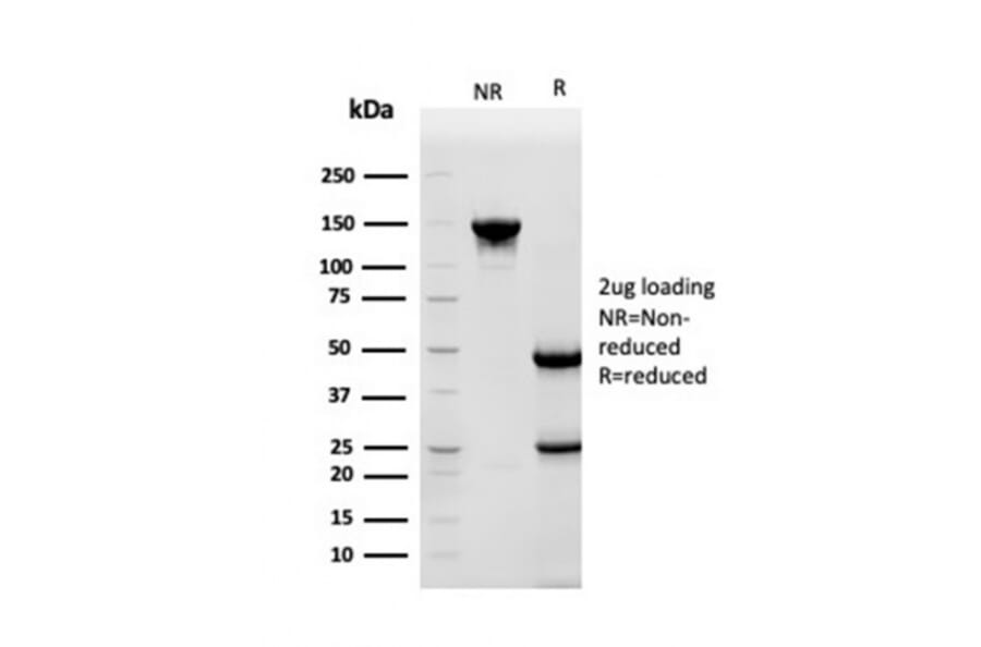 SDS-PAGE - Anti-HSP90 beta Antibody [HSP90AB1/3952] (A248879) - Antibodies.com
