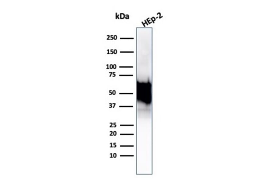 Western Blot - Anti-HSP60 Antibody [rHSPD1/6495] (A248882) - Antibodies.com