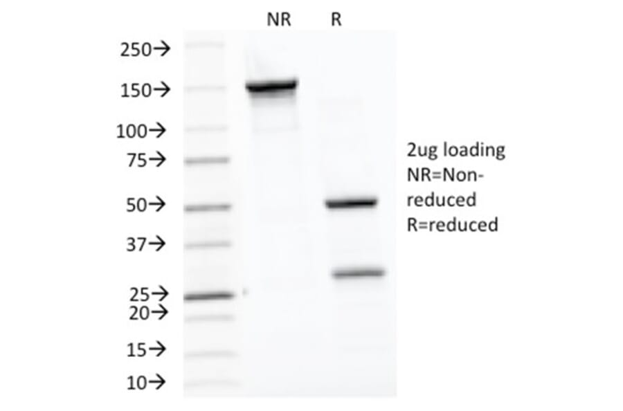SDS-PAGE - Anti-HSP60 Antibody [LK1] (A248883) - Antibodies.com