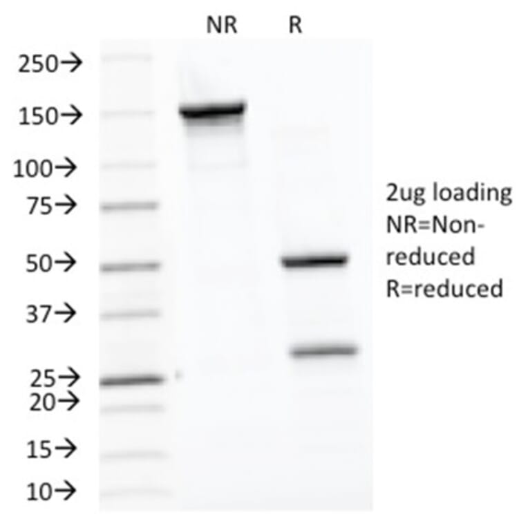 SDS-PAGE - Anti-HSP60 Antibody [LK1] (A248883) - Antibodies.com