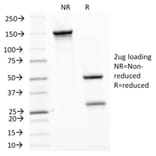 SDS-PAGE - Anti-HSP60 Antibody [LK1] (A248883) - Antibodies.com