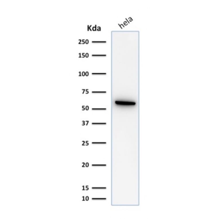 Western Blot - Anti-HSP60 Antibody [SPM253] (A248884) - Antibodies.com