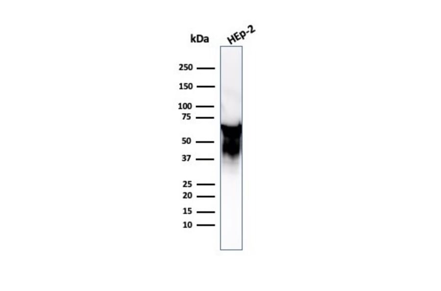 Western Blot - Anti-HSP60 Antibody [LK2] (A248885) - Antibodies.com