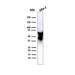 Western Blot - Anti-HSP60 Antibody [LK2] (A248885) - Antibodies.com