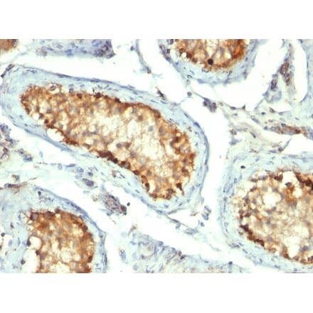 Immunohistochemistry - Anti-HSP60 Antibody [GROEL/730] (A248886) - Antibodies.com