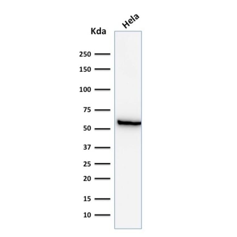 Western Blot - Anti-HSP60 Antibody [GROEL/730] (A248886) - Antibodies.com
