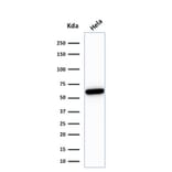 Western Blot - Anti-HSP60 Antibody [HSPD1/780] (A248887) - Antibodies.com