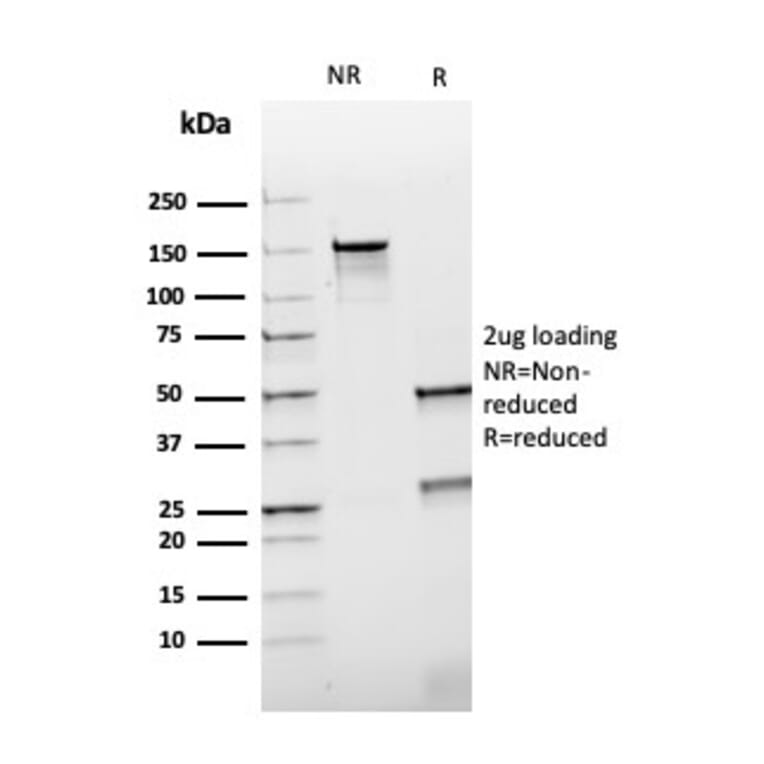 SDS-PAGE - Anti-HSP60 Antibody [rGROEL/780] (A248889) - Antibodies.com
