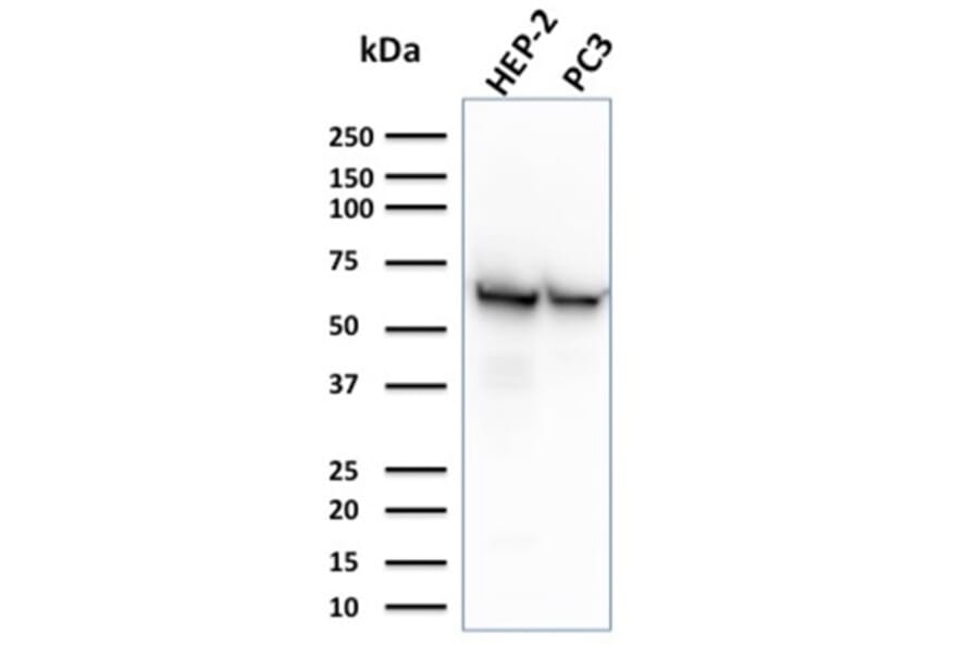 Western Blot - Anti-HSP60 Antibody [CPTC-HSPD1-1] (A248890) - Antibodies.com