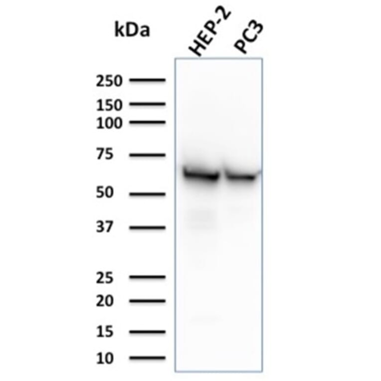 Western Blot - Anti-HSP60 Antibody [CPTC-HSPD1-1] (A248890) - Antibodies.com