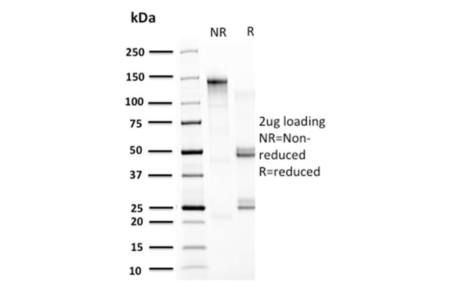 SDS-PAGE - Anti-HSP60 Antibody [CPTC-HSPD1-1] (A248890) - Antibodies.com