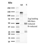 SDS-PAGE - Anti-HSP60 Antibody [CPTC-HSPD1-1] (A248890) - Antibodies.com