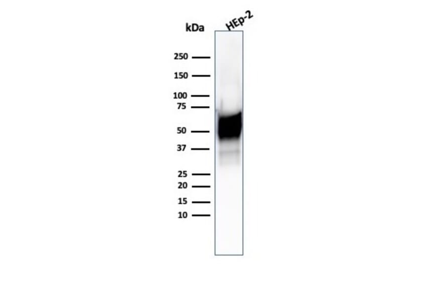 Western Blot - Anti-HSP60 Antibody [HSPD1/6496R] (A248892) - Antibodies.com