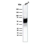 Western Blot - Anti-HSP60 Antibody [HSPD1/6496R] (A248892) - Antibodies.com