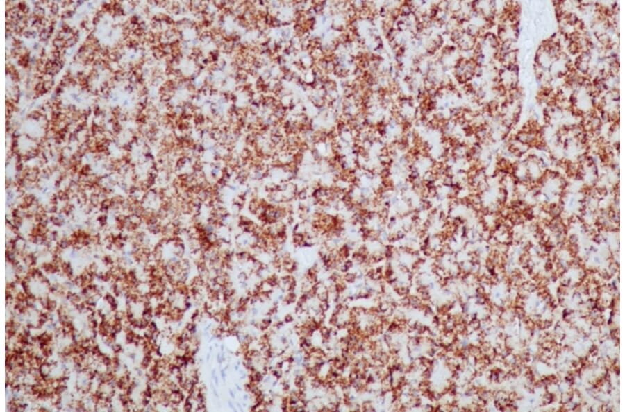 Immunohistochemistry - Anti-HSP60 Antibody [HSPD1/2206R] (A248892) - Antibodies.com