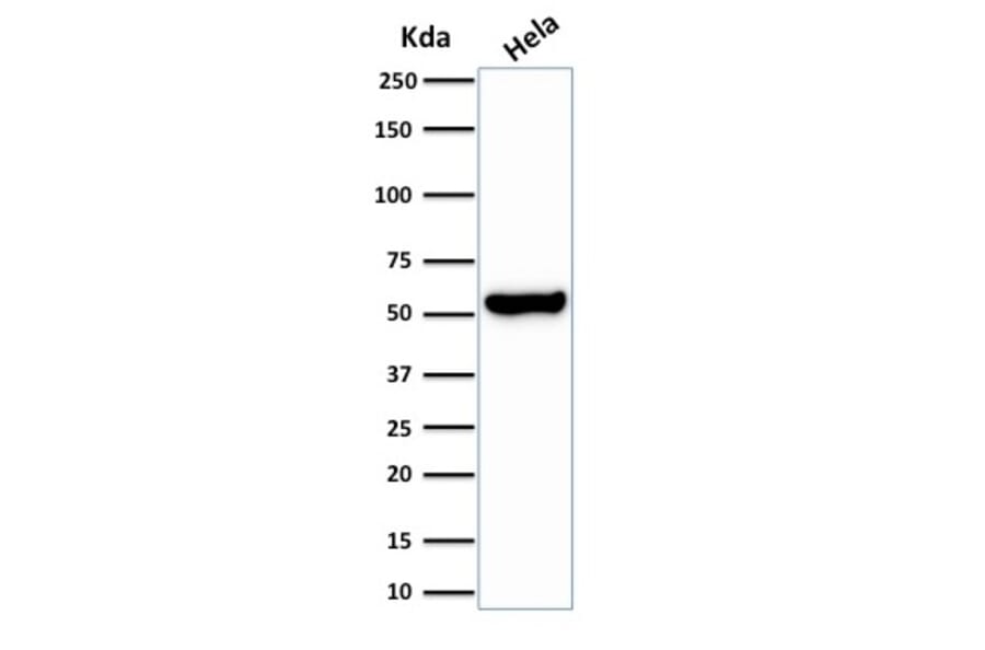 Western Blot - Anti-HSP60 Antibody [HSPD1/2206R] (A248893) - Antibodies.com