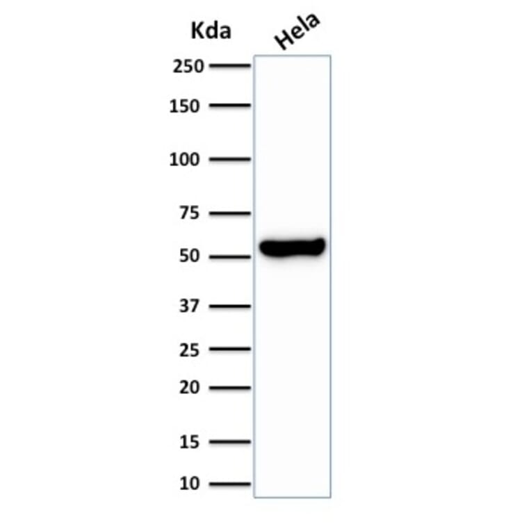 Western Blot - Anti-HSP60 Antibody [HSPD1/2206R] (A248893) - Antibodies.com