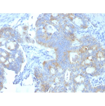 Immunohistochemistry - Anti-Heparan Sulfate Proteoglycan Antibody [A7L6] (A248893) - Antibodies.com