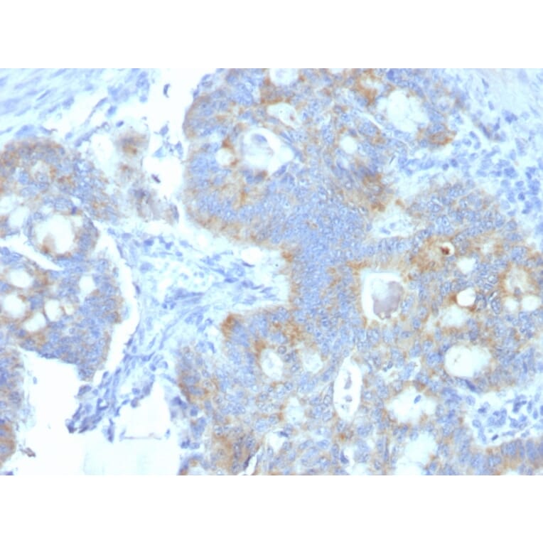 Immunohistochemistry - Anti-Heparan Sulfate Proteoglycan Antibody [A7L6] (A248893) - Antibodies.com