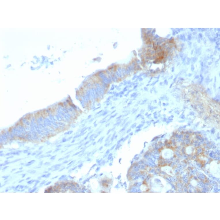 Immunohistochemistry - Anti-Heparan Sulfate Proteoglycan Antibody [SPM255] (A248894) - Antibodies.com