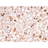 Immunohistochemistry - Anti-Apolipoprotein A1 Antibody [APOA1/3661] (A248896) - Antibodies.com