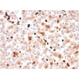 Immunohistochemistry - Anti-Apolipoprotein A1 Antibody [APOA1/3661] (A248895) - Antibodies.com