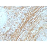 Immunohistochemistry - Anti-Tenascin C Antibody [T2H5] (A248896) - Antibodies.com