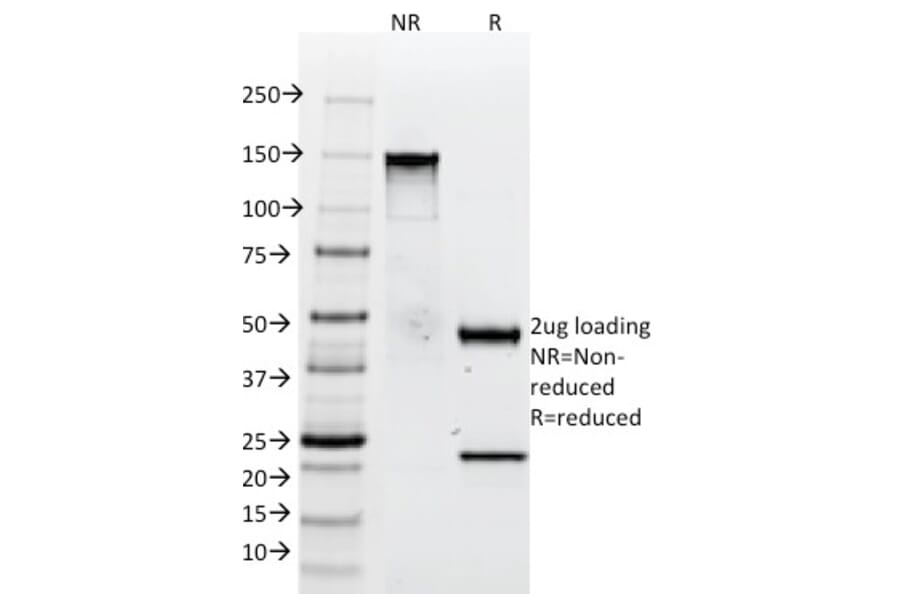 SDS-PAGE - Anti-Tenascin C Antibody [SPM319] (A248898) - Antibodies.com