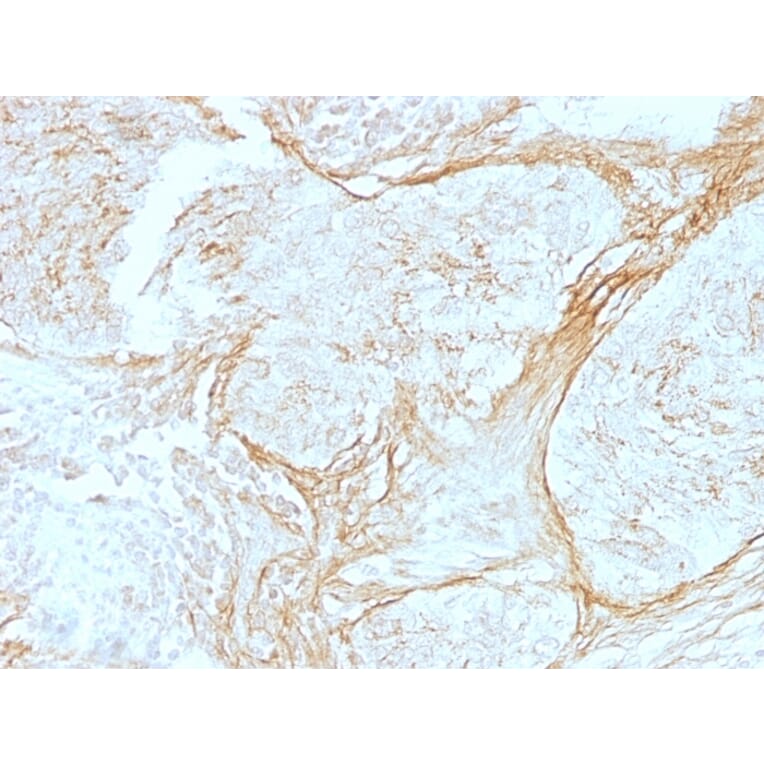 Immunohistochemistry - Anti-Tenascin C Antibody [SPM319] (A248897) - Antibodies.com