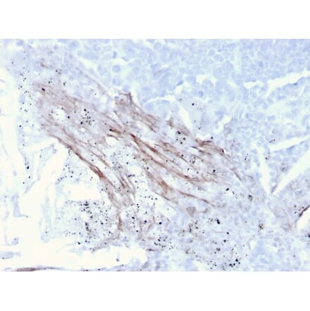 Immunohistochemistry - Anti-Tenascin C Antibody [rTNC/3635] (A248898) - Antibodies.com