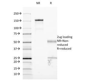 SDS-PAGE - Anti-ICAM1 Antibody [W-CAM-1] (A248902) - Antibodies.com