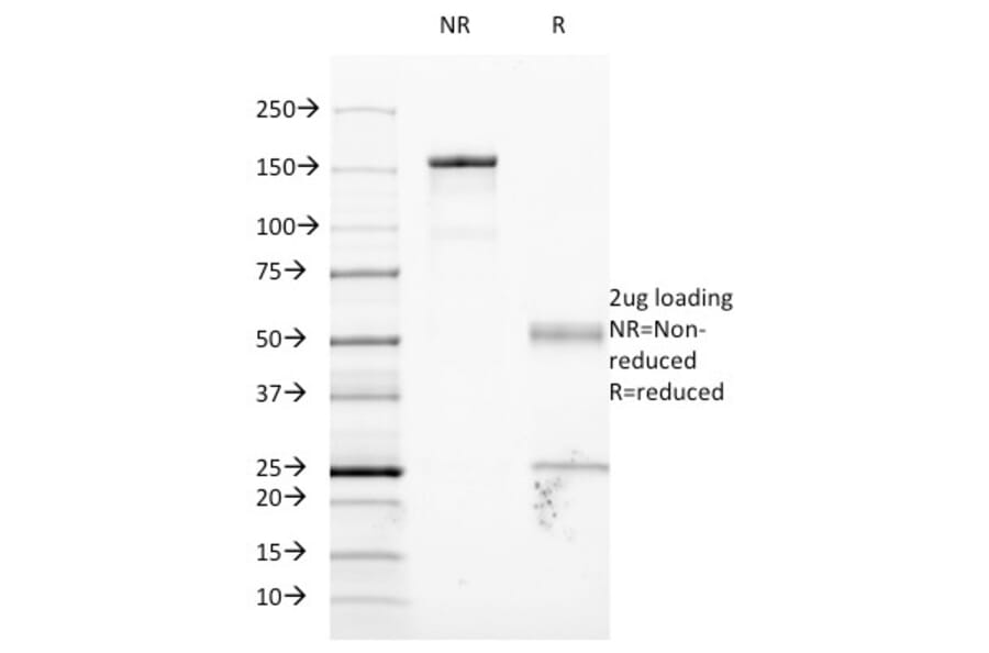 SDS-PAGE - Anti-ICAM1 Antibody [W-CAM-1] (A248902) - Antibodies.com
