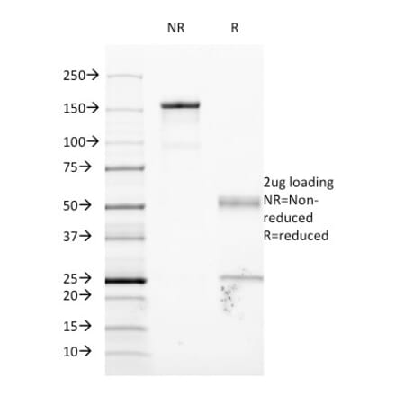 SDS-PAGE - Anti-ICAM1 Antibody [W-CAM-1] (A248902) - Antibodies.com