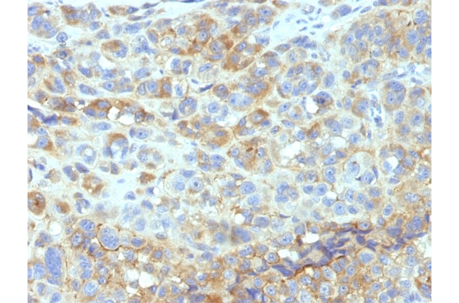 Immunohistochemistry - Anti-ICAM1 Antibody [W-CAM-1] (A248901) - Antibodies.com