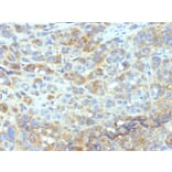 Immunohistochemistry - Anti-ICAM1 Antibody [W-CAM-1] (A248901) - Antibodies.com