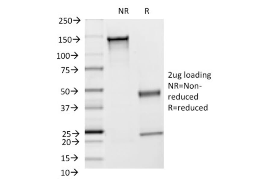 SDS-PAGE - Anti-ICAM1 Antibody [F4-31C2] (A248902) - Antibodies.com