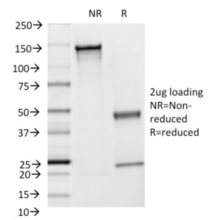 SDS-PAGE - Anti-ICAM1 Antibody [F4-31C2] (A248902) - Antibodies.com