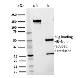 SDS-PAGE - Anti-ICAM1 Antibody [15.2] (A248903) - Antibodies.com