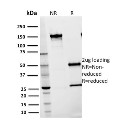 SDS-PAGE - Anti-ICAM1 Antibody [15.2] (A248903) - Antibodies.com