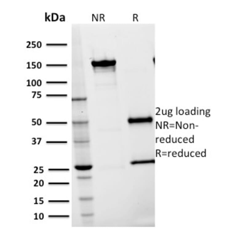 SDS-PAGE - Anti-ICAM1 Antibody [15.2] (A248903) - Antibodies.com