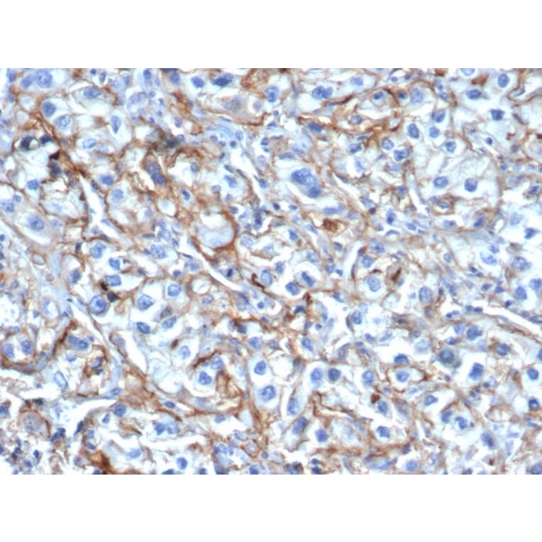 Immunohistochemistry - Anti-ICAM1 Antibody [P2A4] (A248905) - Antibodies.com