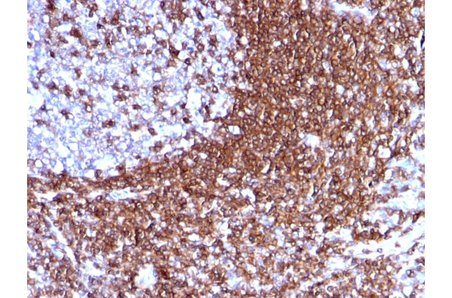 Immunohistochemistry - Anti-ICAM3 Antibody [186-2G9] (A248905) - Antibodies.com