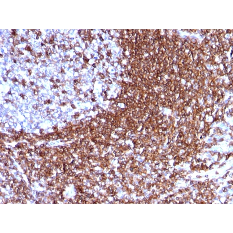 Immunohistochemistry - Anti-ICAM3 Antibody [186-2G9] (A248905) - Antibodies.com