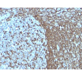 Immunohistochemistry - Anti-ICAM3 Antibody [SPM505] (A248906) - Antibodies.com