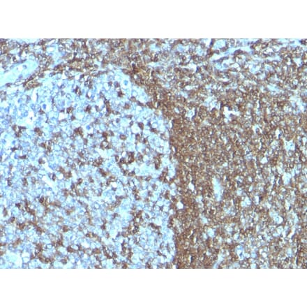 Immunohistochemistry - Anti-ICAM3 Antibody [SPM505] (A248906) - Antibodies.com