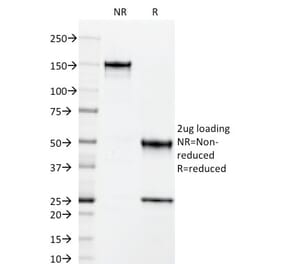 SDS-PAGE - Anti-ICAM3 Antibody [101-1D2] (A248907) - Antibodies.com