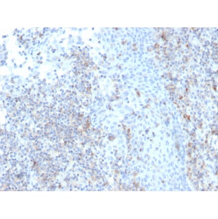 Immunohistochemistry - Anti-ICAM3 Antibody [rICAM3/1019] (A248911) - Antibodies.com