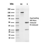 SDS-PAGE - Anti-ICAM3 Antibody [rICAM3/1019] (A248912) - Antibodies.com